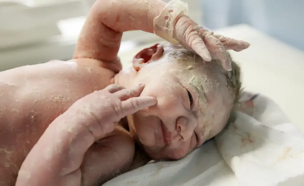 Recién nacido cubierto de vernix, con una mano tocando su cara.