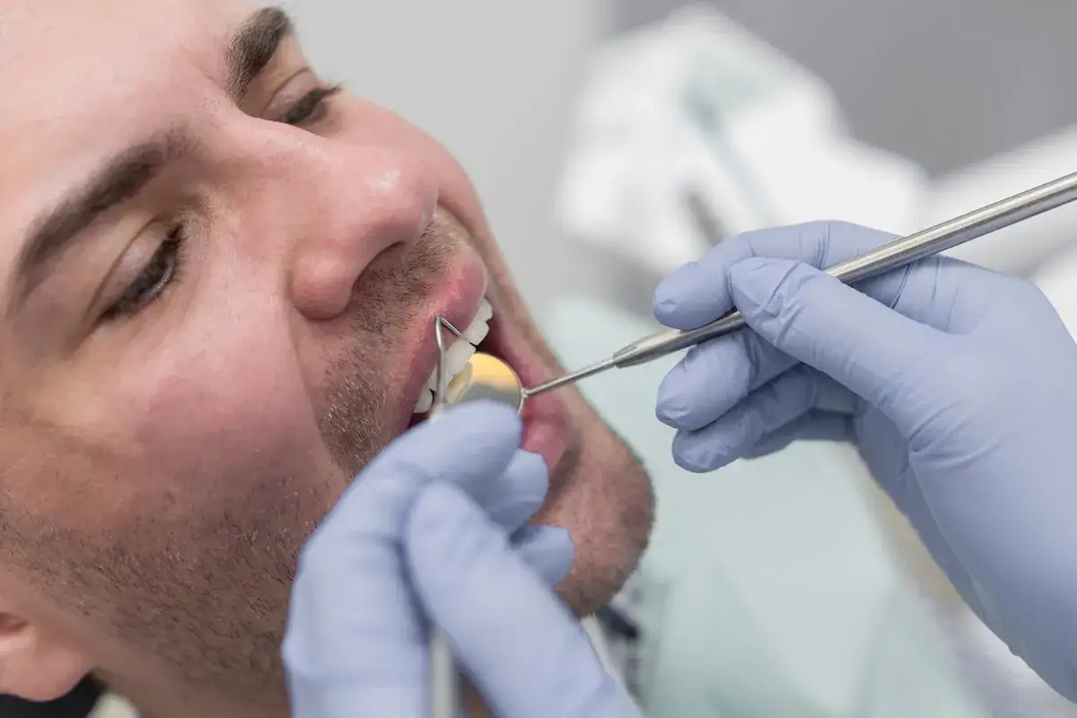 Dentysta bada ukruszoną jedynkę pacjenta za pomocą lusterka i narzędzia.