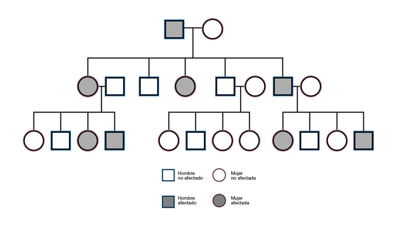 Árbol genealógico que muestra la herencia dominante. Individuos afectados (cuadrados y círculos grises) aparecen en varias generaciones.