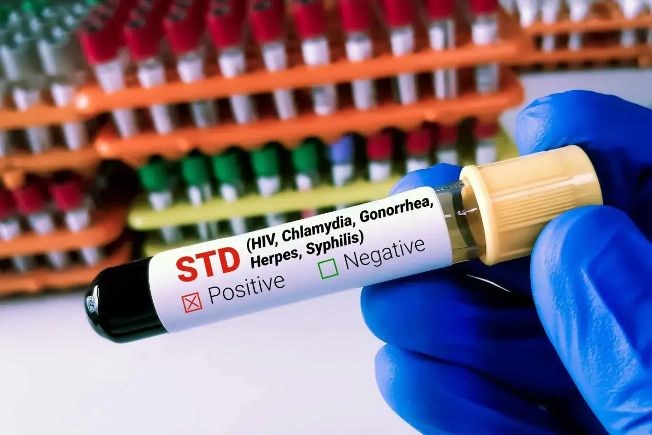 Wynik badania na choroby weneryczne (HIV, Chlamydia, Gonorrhea, Herpes, Syphilis) jest pozytywny.