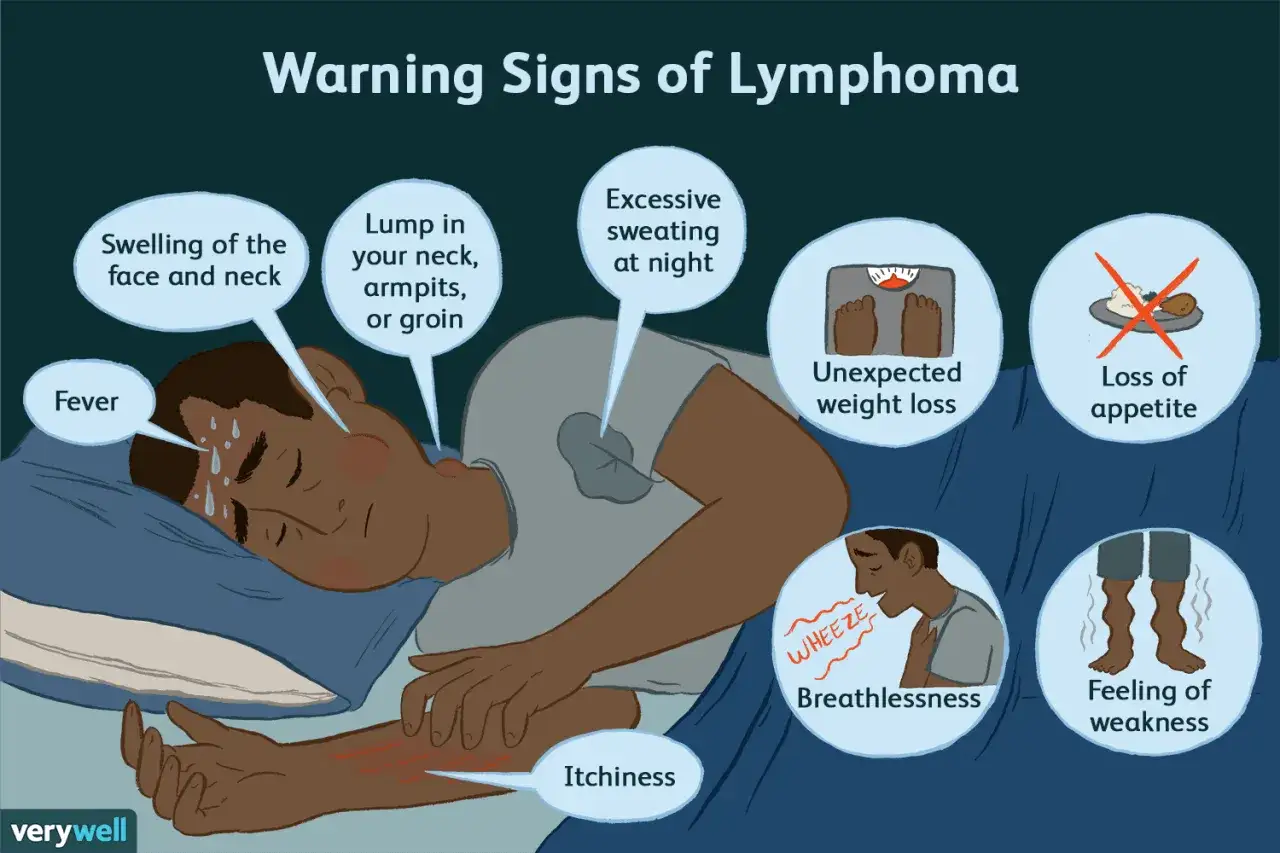 Warnzeichen von Lymphomen, wie Fieber, Schwellungen, Nachtschwei&szlig;, Gewichtsverlust, Appetitlosigkeit, Atemnot, Schw&auml;che und Juckreiz, k&ouml;nnen auf ein Burkitt-Lymphom hindeuten.