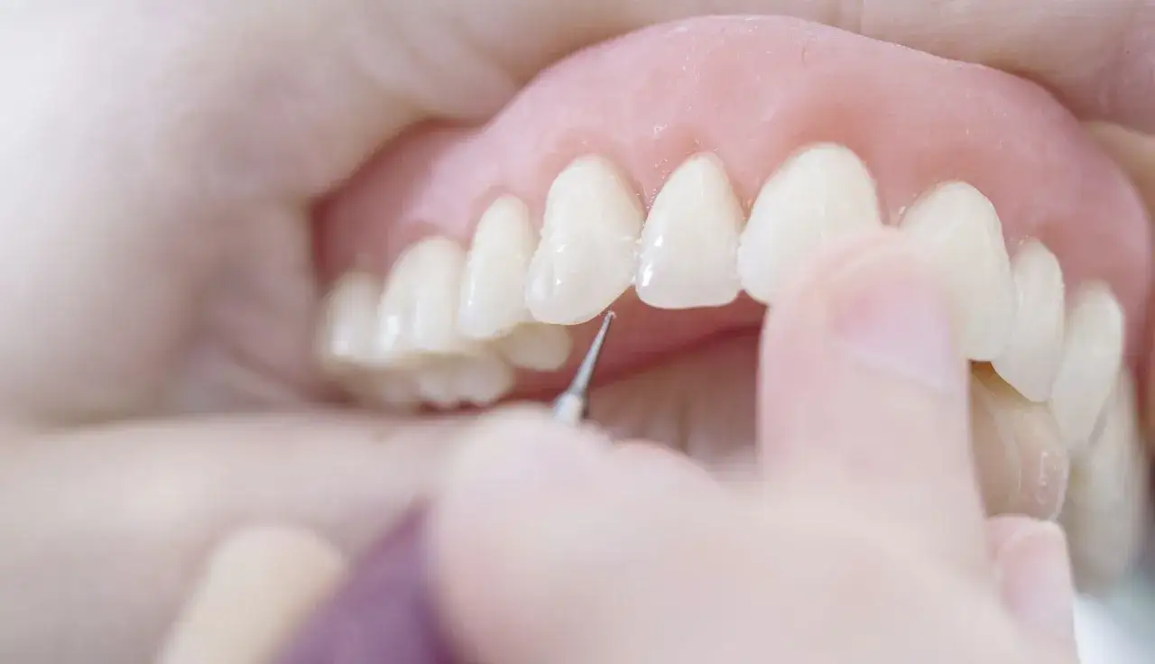 Un dentista esamina un dente che si muove, mostrando che un dente che si muove si pu&ograve; salvare con cure adeguate.