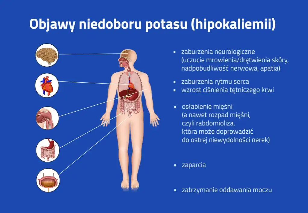przyczyny niedoboru potasu infografika