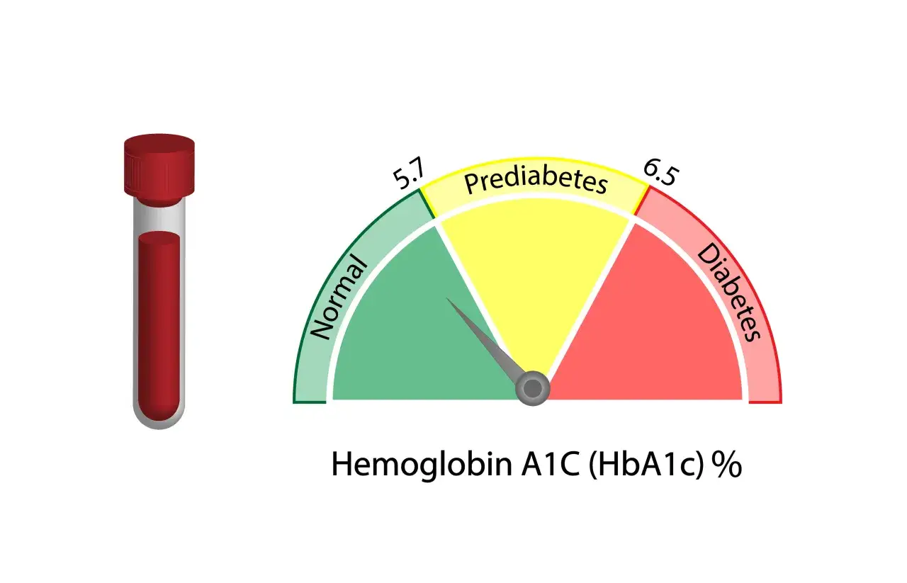 Probówka z krwią obok wskaźnika poziomu hemoglobiny A1C (HbA1c), pokazującego zakresy: normalny, stan przedcukrzycowy i cukrzyca.