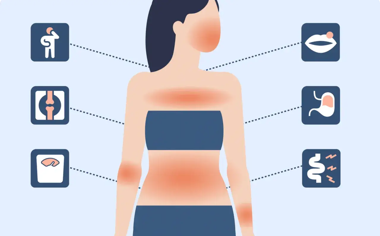 Darstellung von **Morbus Crohn Symptome Frau**: Gelenkschmerzen, Gewichtsverlust, Mundgeschwüre, Magen-Darm-Beschwerden und Müdigkeit.