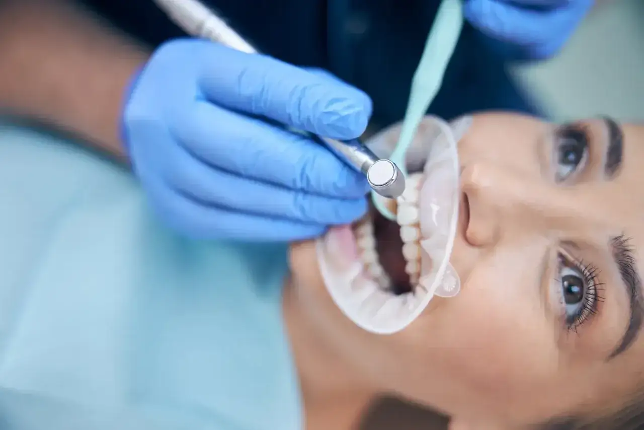 Dentysta pracuje nad zębami pacjentki, kt&oacute;ra ma otwarty zgryz.
