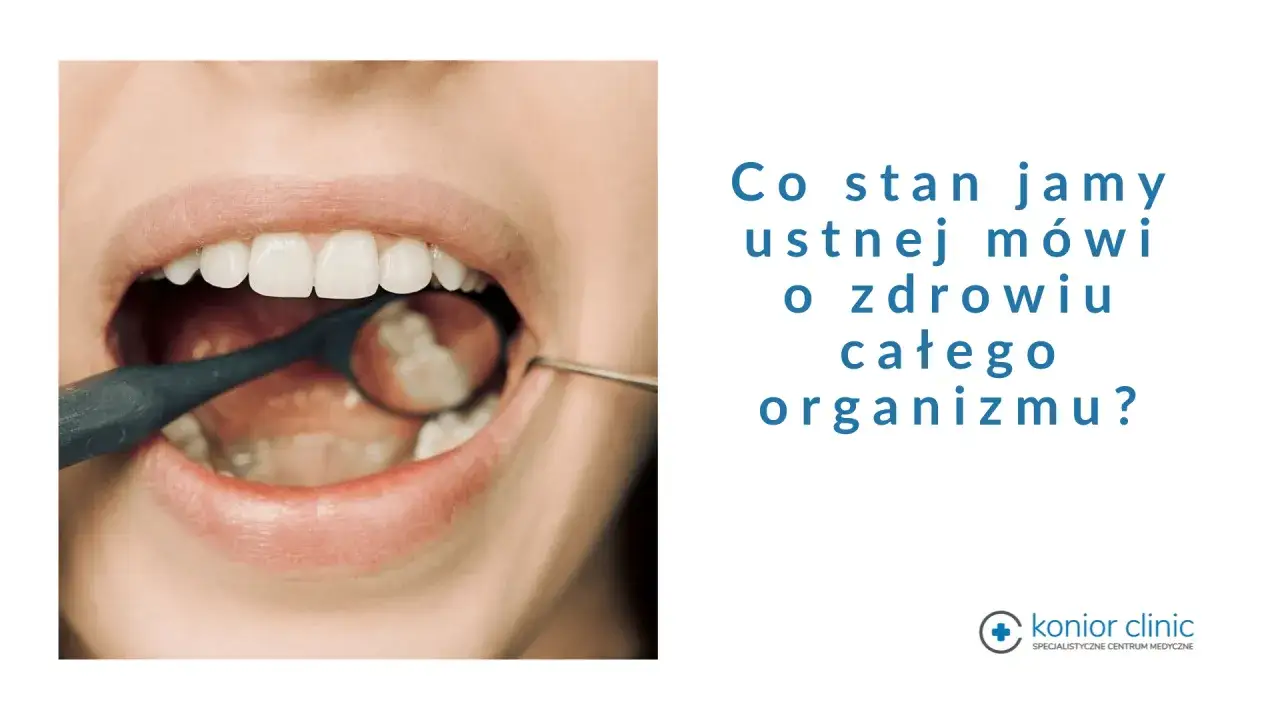Zbliżenie na otwartą jamę ustną z lustrem dentystycznym. Tekst: