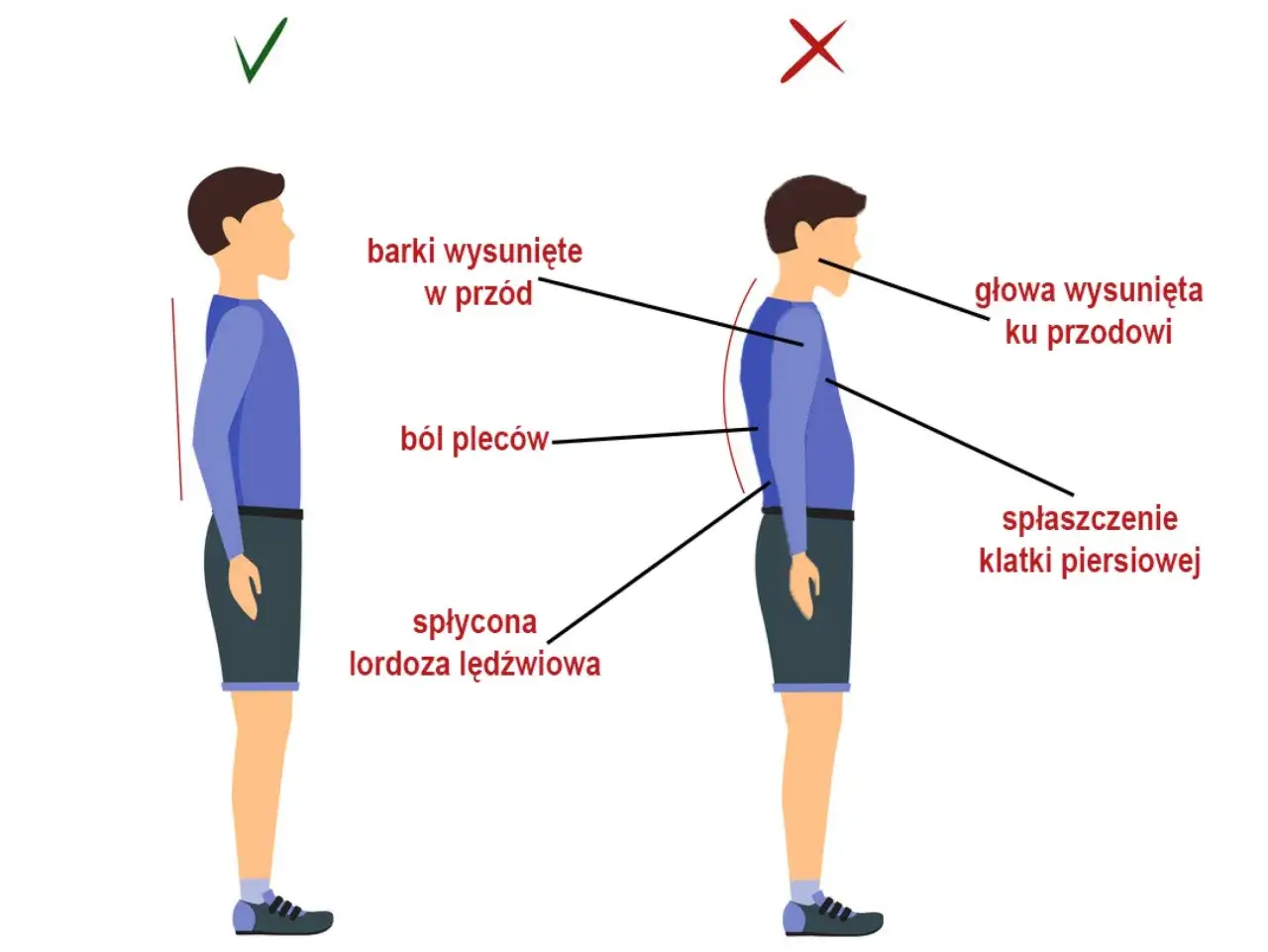 Prawidłowa postawa (✓) vs. zgarbiona (X) z wysuniętymi barkami, bólem pleców i spłyconą lordozą. Zzzsk.