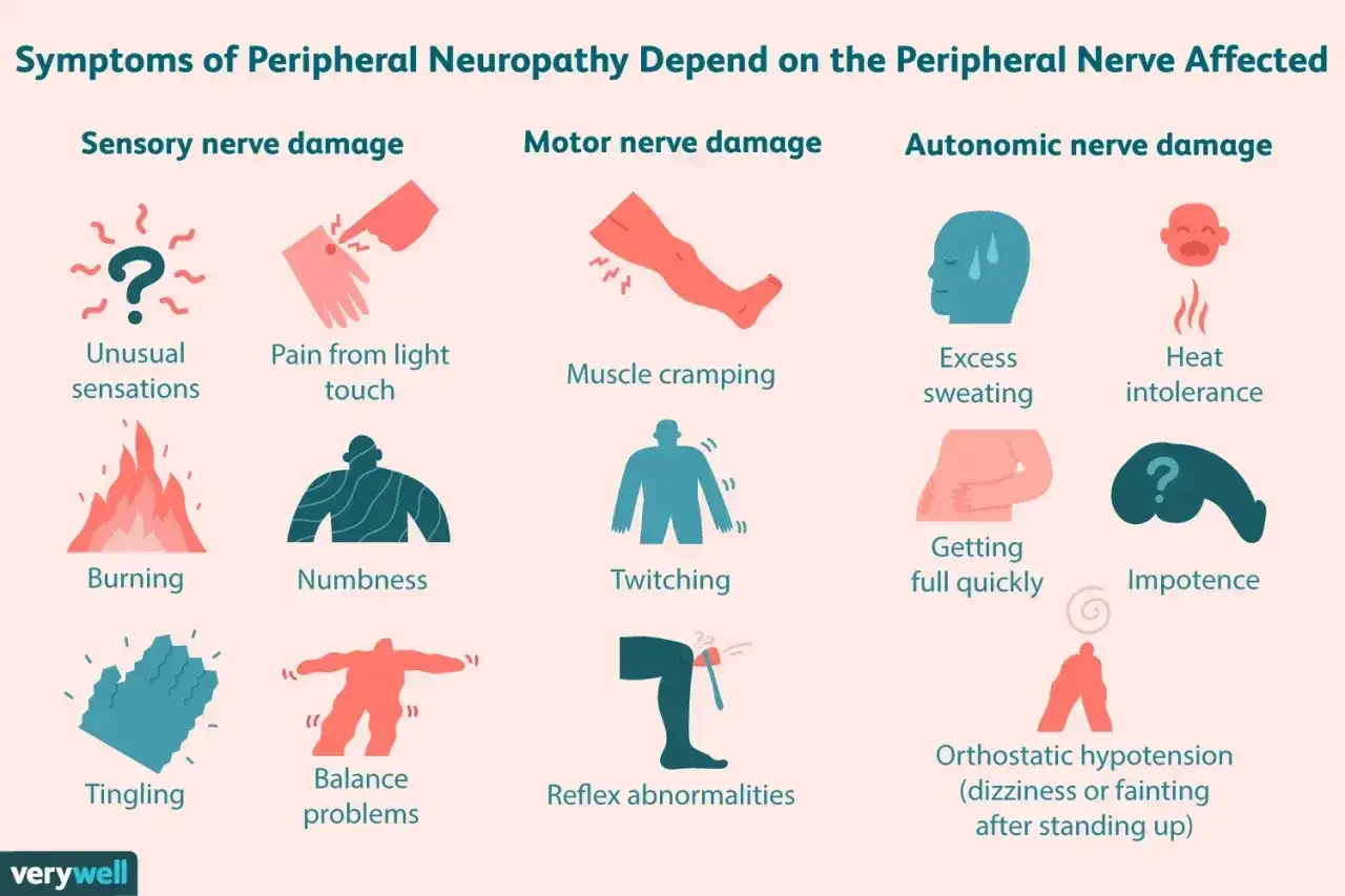 Objawy neuropatii obwodowej: mrowienie, pieczenie, drętwienie, bóle, skurcze, nadmierne pocenie. Co to jest neuropatia?