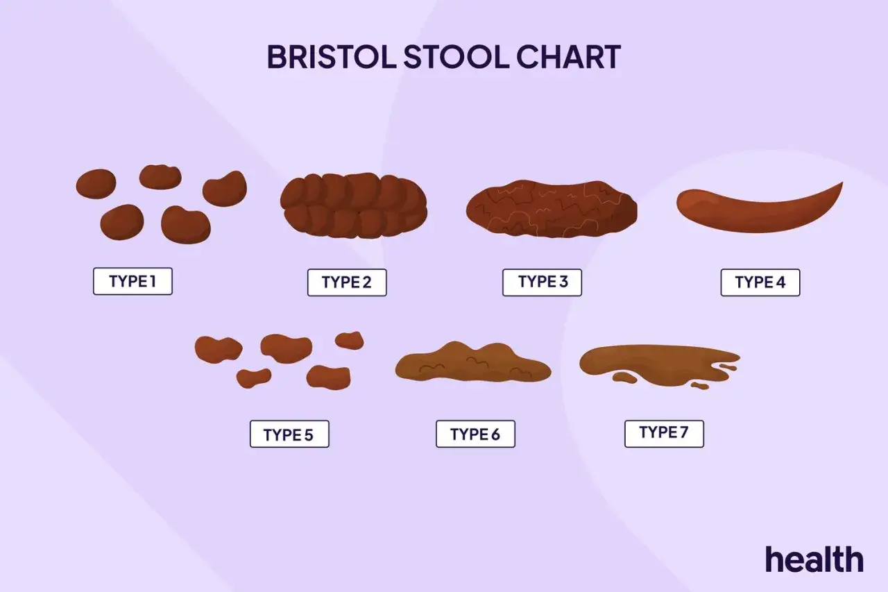 Bristol Stool Chart zeigt 7 Typen von Stuhlkonsistenzen, von harten Klumpen (Typ 1) bis flüssig (Typ 7). Typ 4 repräsentiert den perfekten Stuhlgang.