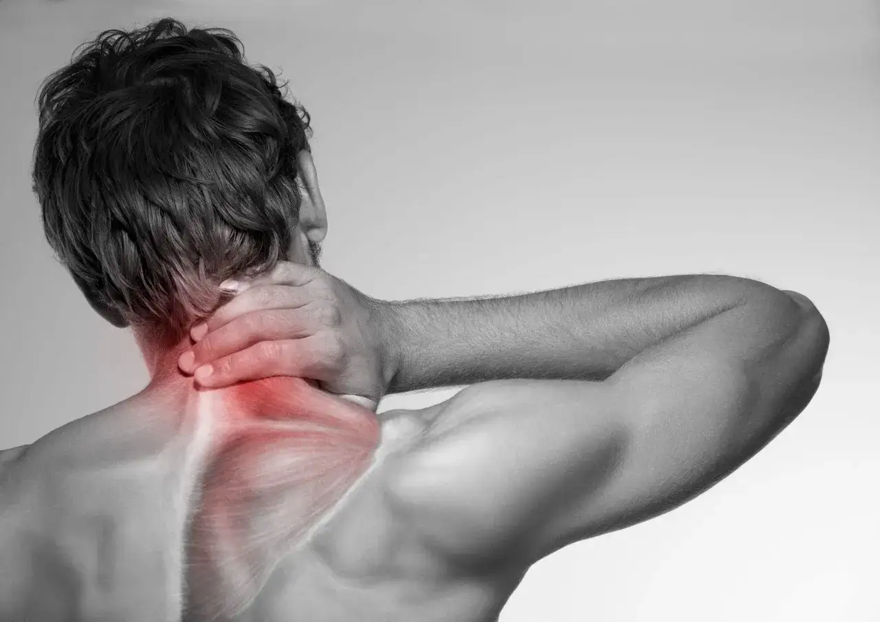 Douleur au muscle trapèze supérieur, accentuée en rouge. L'homme se tient la nuque, montrant la tension.