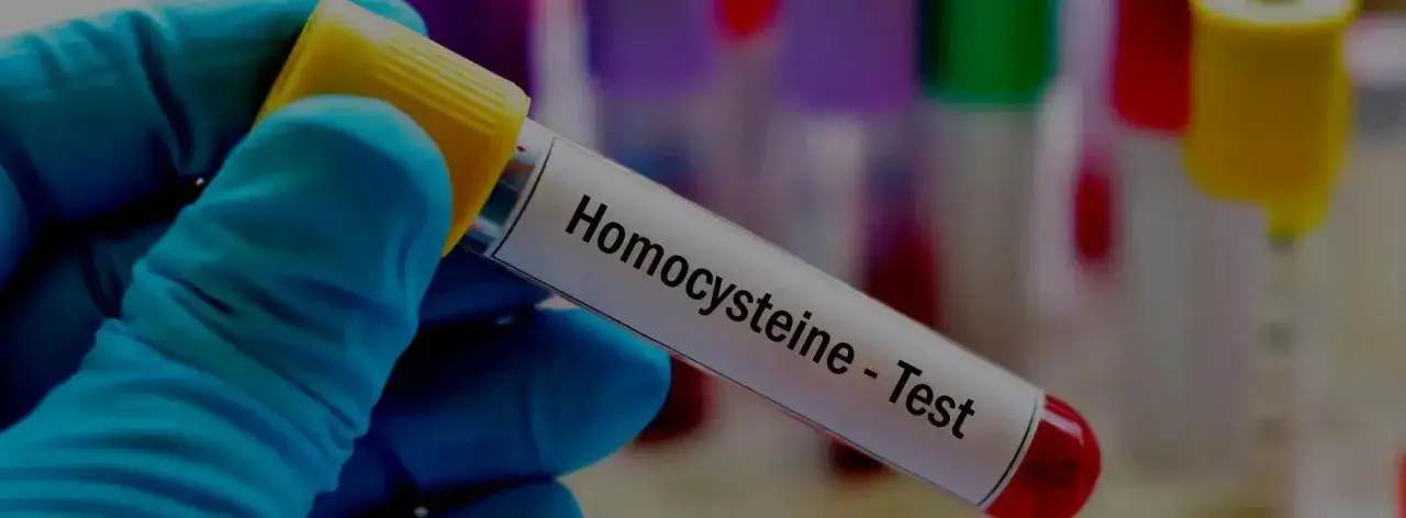 kiedy wykonać badanie homocysteiny