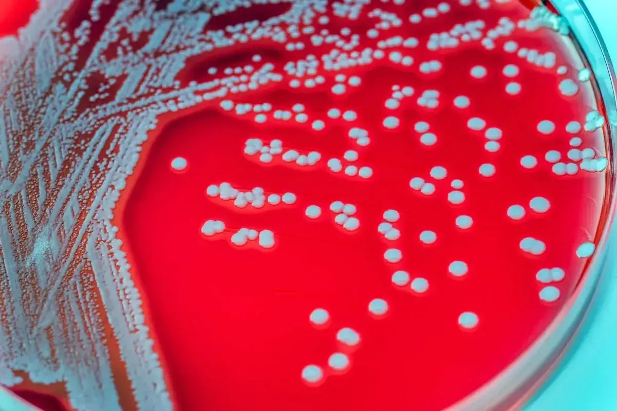 MRSA zakażenie skórne