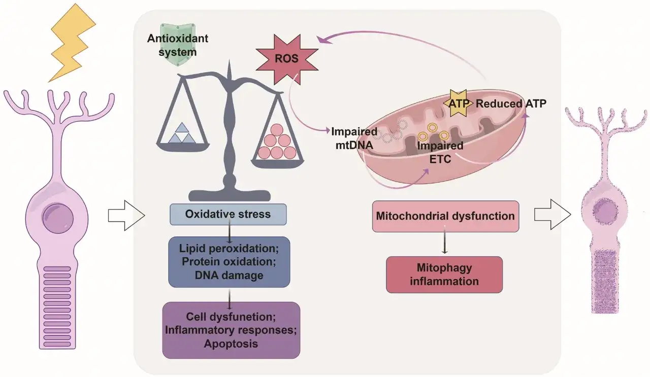 Schema delle cause della retinite pigmentosa: stress ossidativo, danno mitocondriale e infiammazione portano alla disfunzione cellulare.