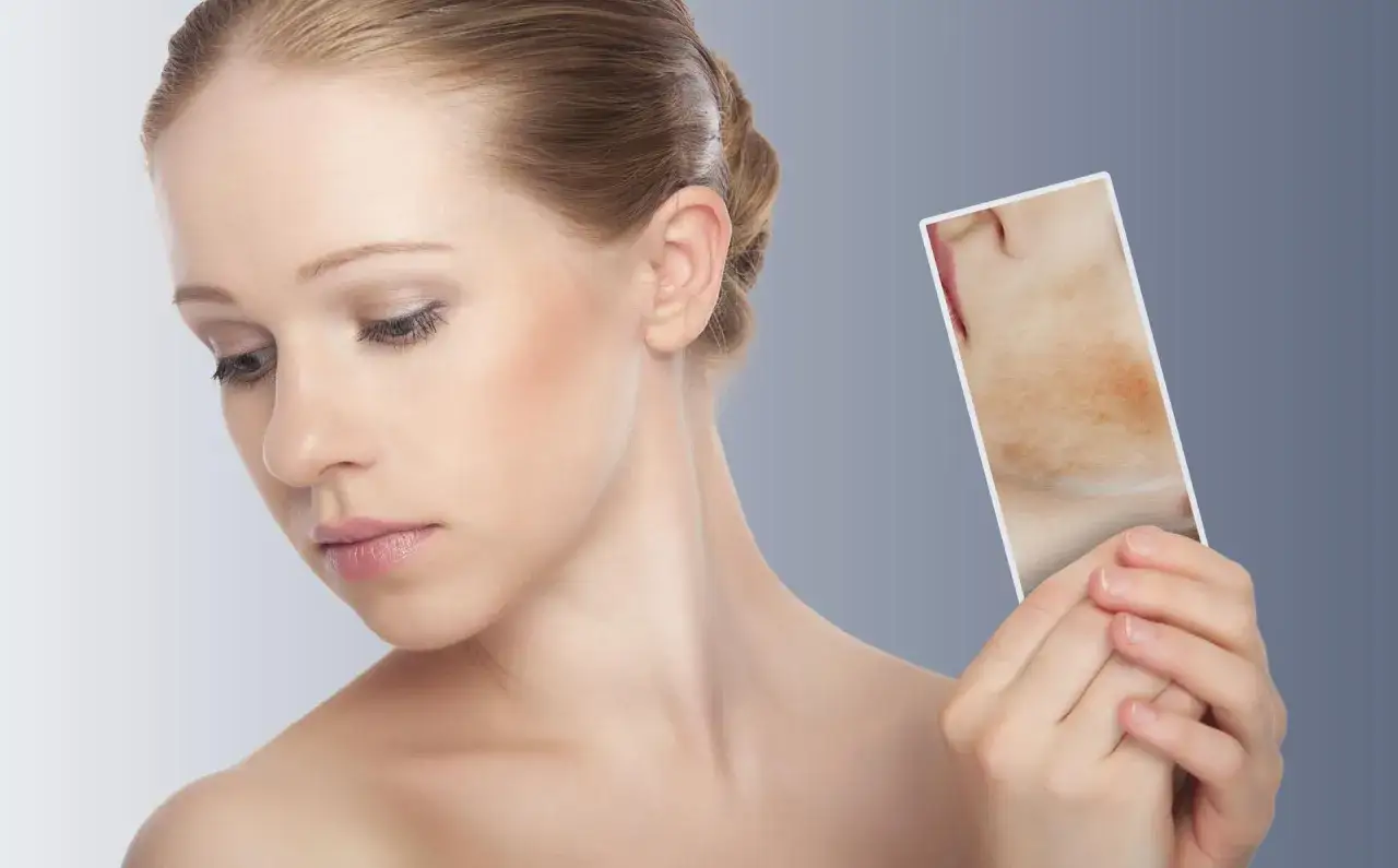 Leczenie psychodermatologiczne