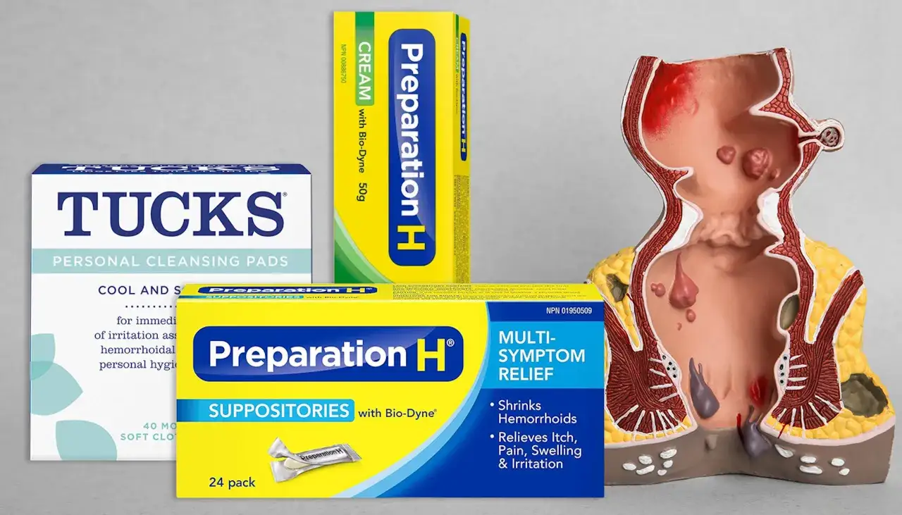 Produkter för lindring av hemorrojder: Tucks pads, Preparation H kräm och suppositorier, samt en anatomisk modell.