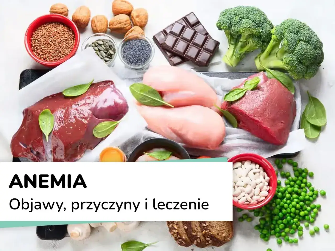 Anemia to niedobór żelaza. Na zdjęciu produkty bogate w żelazo: wątróbka, mięso, brokuły, fasola, szpinak, orzechy, czekolada.