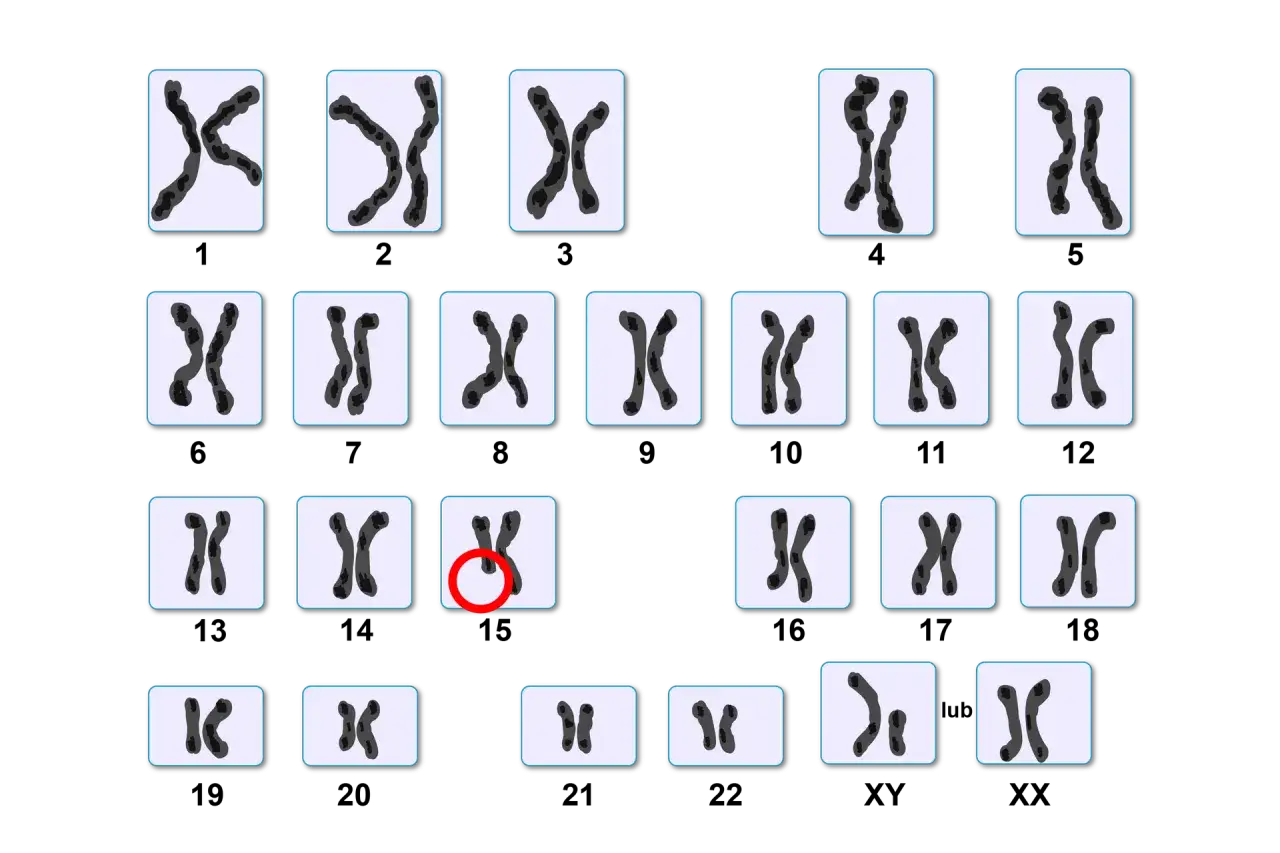 Zestawienie obrazów przedstawiających pary chromosomów, jeden z nich jest zaznaczony czerwonym okręgiem.