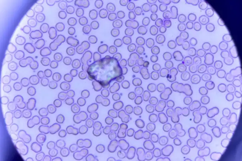 wyniki morfologii krwi, erytrocyty pod mikroskopem
