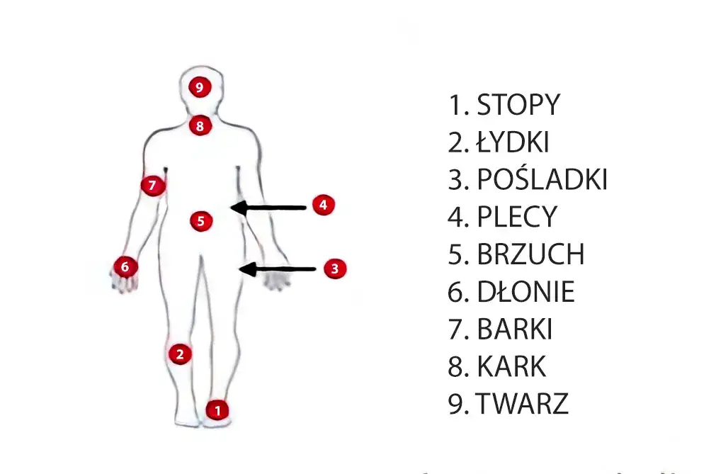 Mapa ciała z zaznaczonymi obszarami bólu przewlekłego