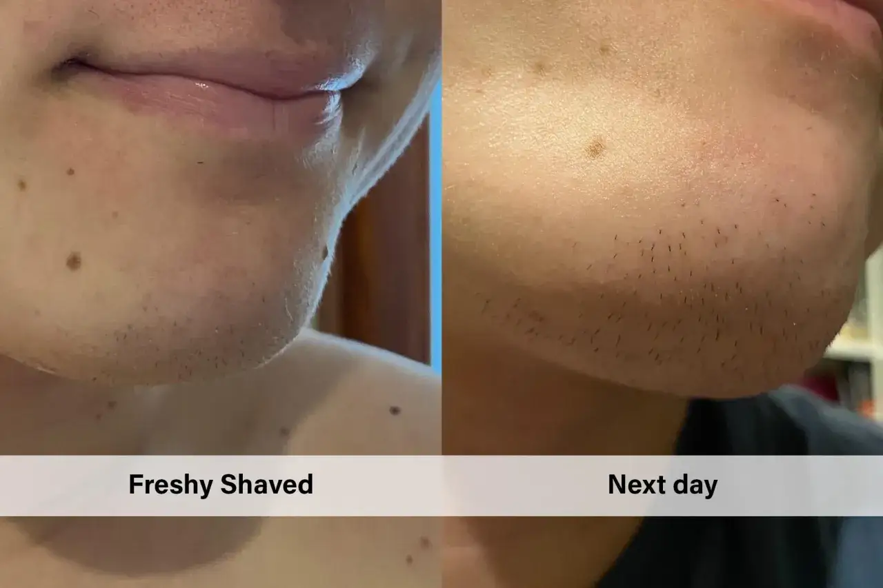 Porównanie skóry: po goleniu i dzień później. Czy peeling przed goleniem pomoże?