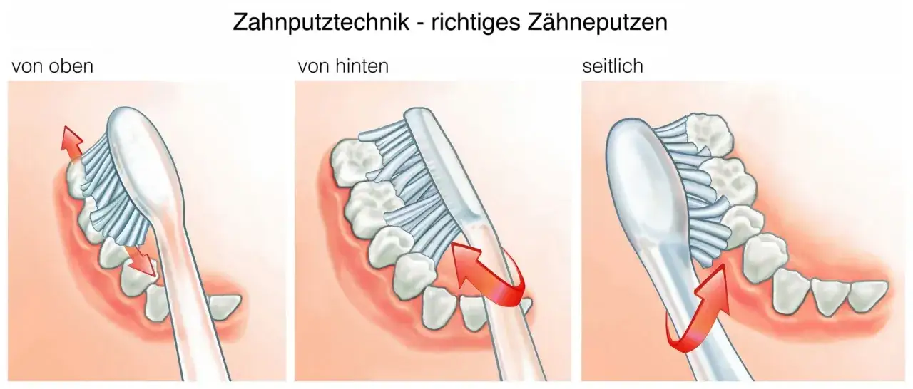 Ilustracje pokazują, jak prawidłowo myć zęby: od góry, od tyłu i z boku, z użyciem czerwonych strzałek wskazujących ruch szczoteczki.