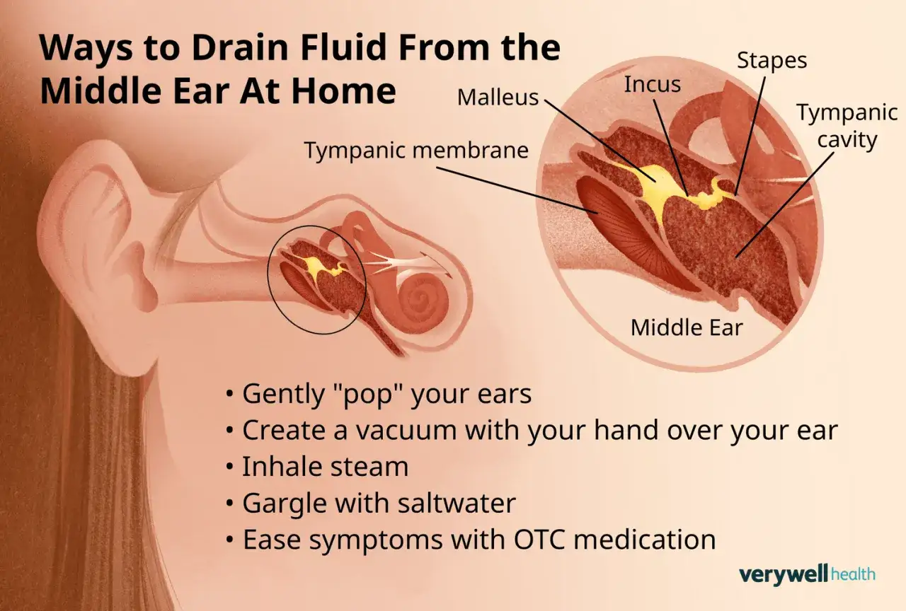 Illustrazione dell'orecchio che mostra come far uscire l'acqua nelle orecchie. Suggerimenti: 