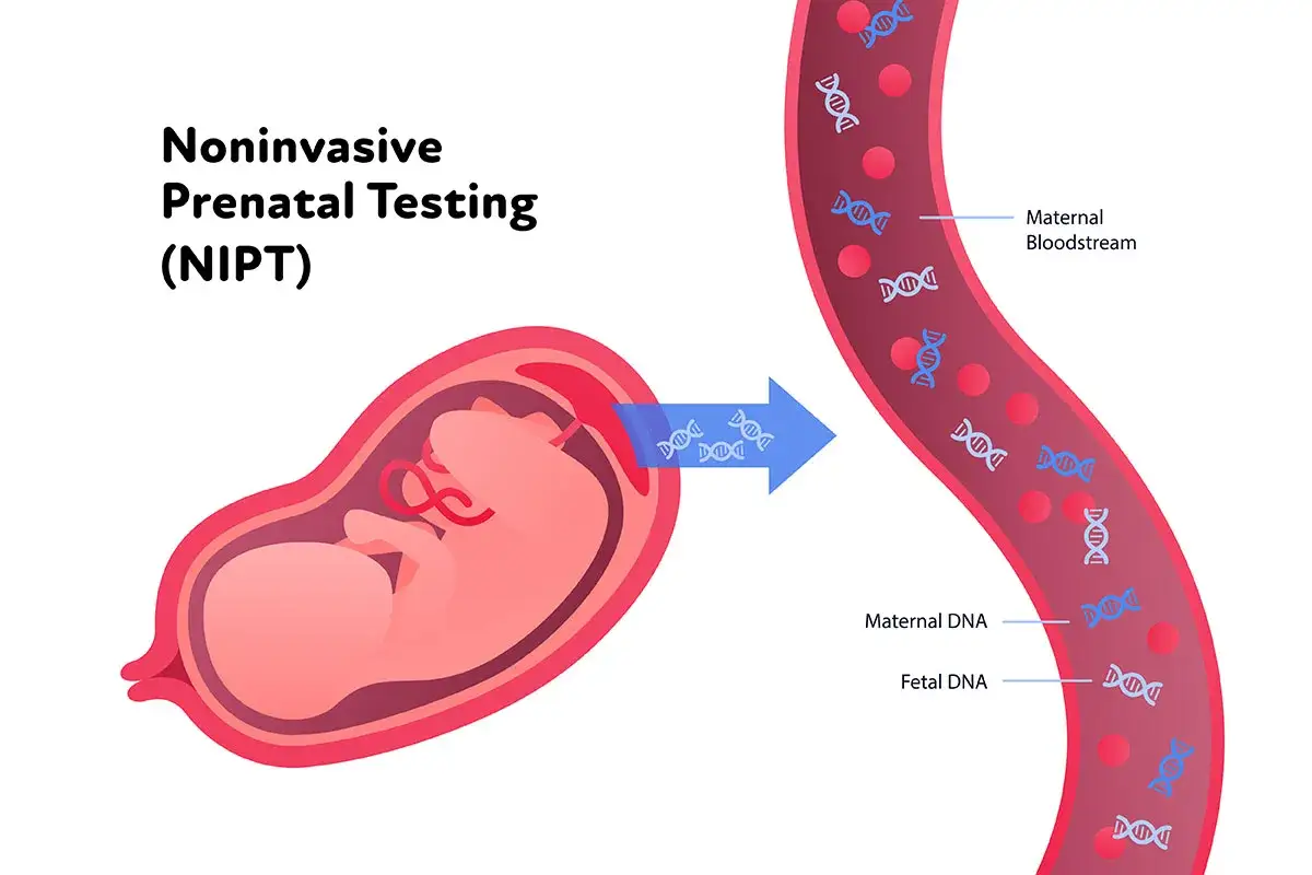 NIPT, czyli nifty pro, to nieinwazyjne badanie prenatalne. Pokazuje ono płód w macicy i przepływ DNA płodowego do krwiobiegu matki.