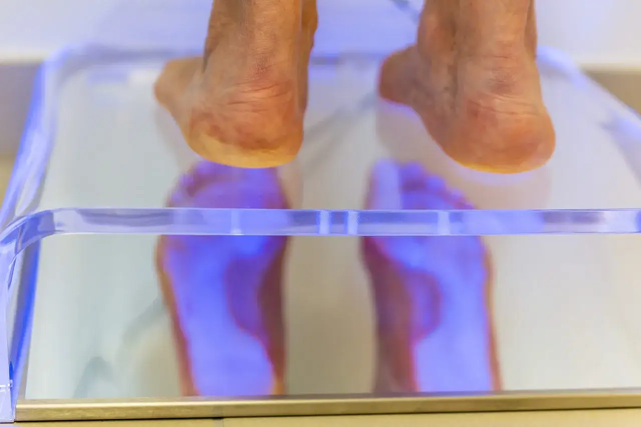 Pieds sur une plateforme lumineuse pour une ordonnance podologue semelle sur mesure.