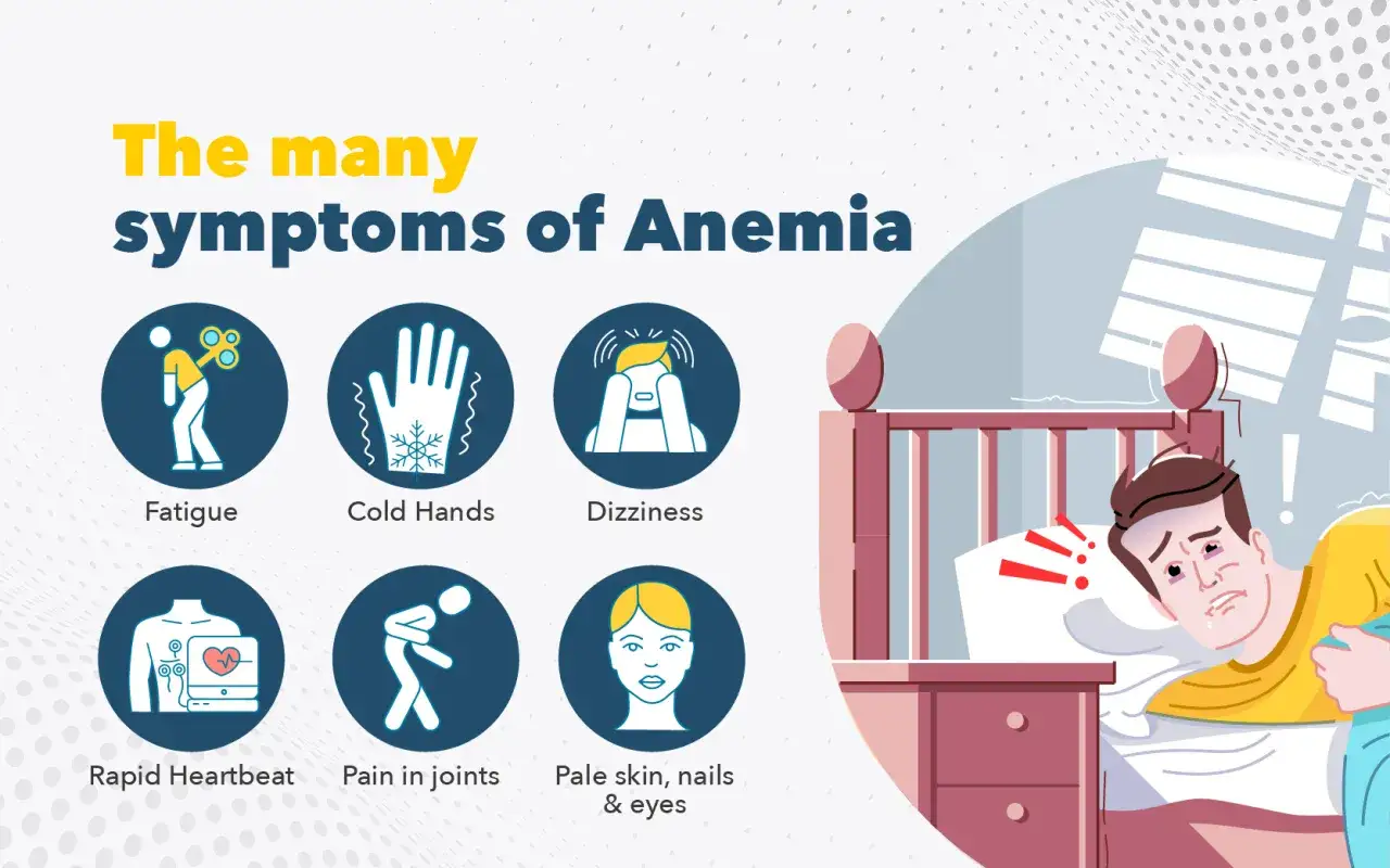 Objawy anemii: zmęczenie, zimne dłonie, zawroty głowy, szybkie bicie serca, bóle stawów, blada skóra. Dowiedz się, co to anemia.