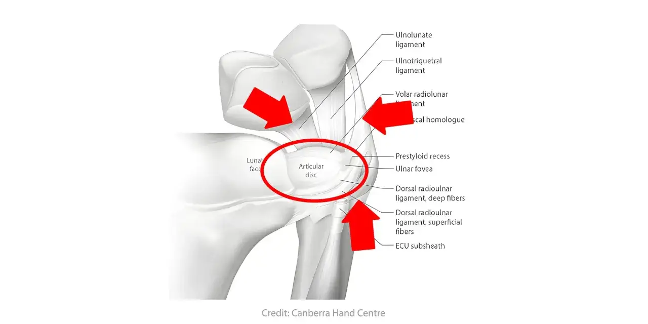 Anatomische Darstellung des Handgelenks mit roten Pfeilen, die auf den Discus articularis und die B&auml;nder hinweisen. M&ouml;glicher Grund f&uuml;r stechender Schmerz im Handgelenk bei Drehbewegung.