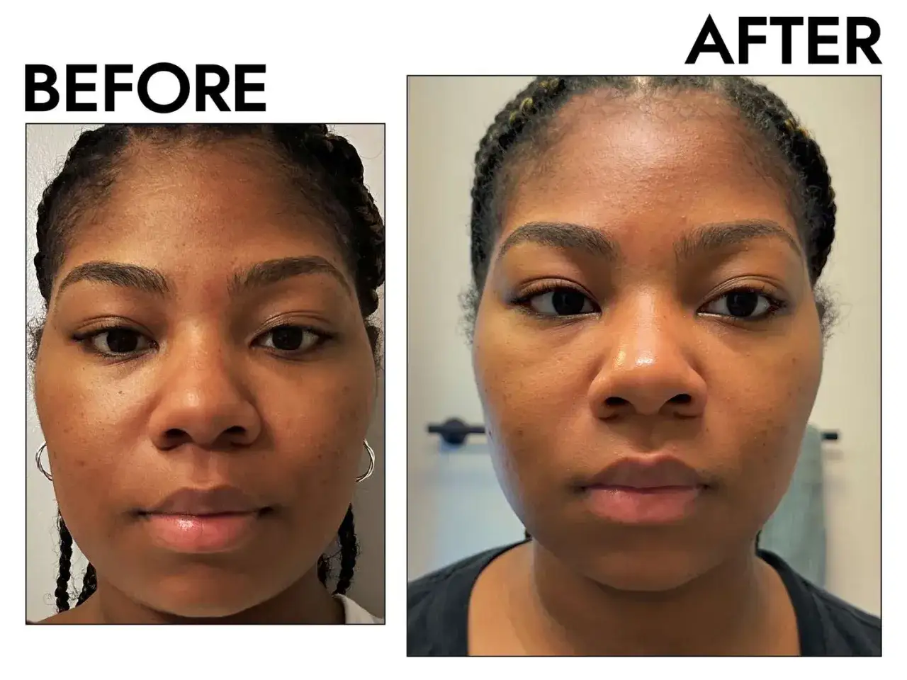 Prima e dopo: la pelle appare pi&ugrave; luminosa e uniforme. Chiss&agrave; quante volte fare lo scrub viso per ottenere questo risultato.