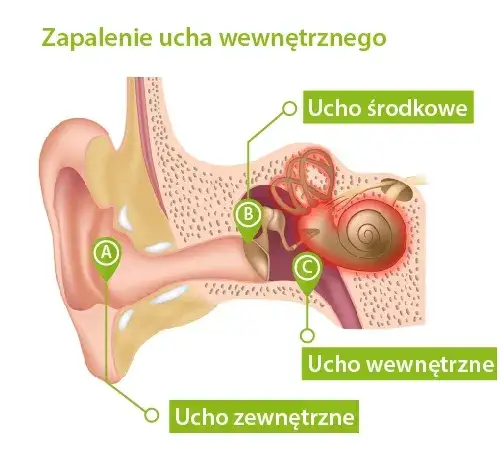 objawy zaburzeń błędnika infografika