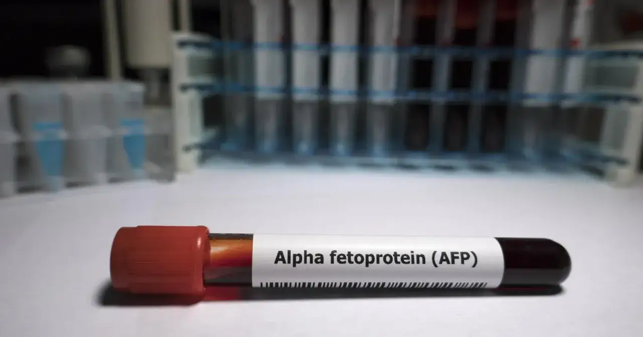 Probówka z krwią do badania AFP. W ciąży normy tego białka są kluczowe dla oceny rozwoju płodu.