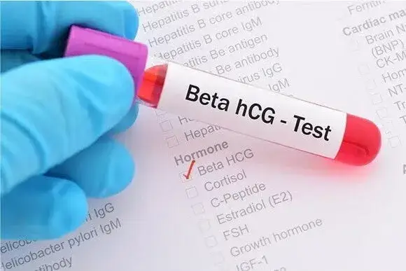 badanie beta-hCG krew ciąża