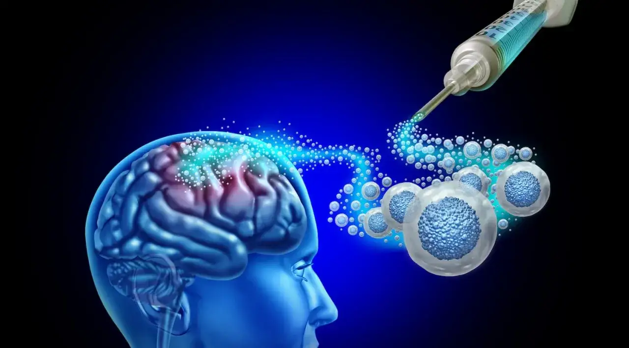Cerveau bleu recevant des cellules souches d'une seringue, symbolisant une avancée pour le parkinson dernière découverte.