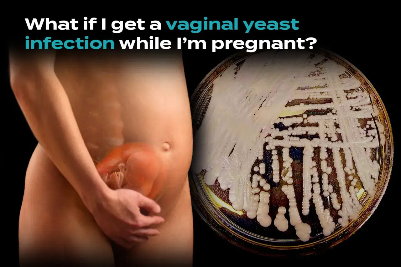Schwanger und Sorgen wegen Scheidenpilz? Die Ursache ist oft ein Ungleichgewicht der Vaginalflora, das durch Hormone begünstigt wird.
