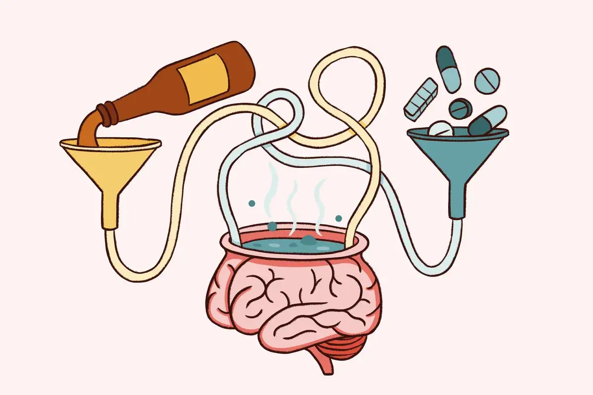Une bouteille verse un liquide dans un entonnoir, reli&eacute; par des tubes &agrave; un cerveau bouillonnant. Des pilules tombent dans un autre entonnoir. Attention au metronidazole alcool.