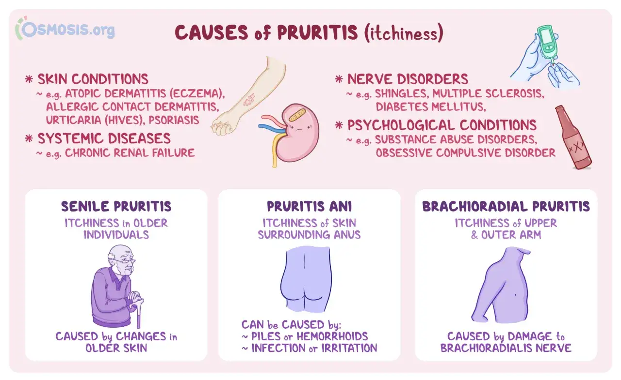 Prurito fondoschiena: cause di prurito, tra cui condizioni della pelle, malattie sistemiche, disturbi nervosi, psicologici, prurito senile, ani e brachioradiale.