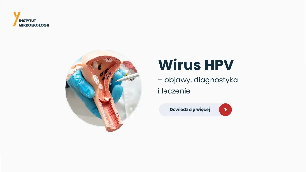 Model narządów rodnych kobiety z widocznymi zmianami, jak wygląda brodawczak. Wirus HPV - objawy, diagnostyka i leczenie.