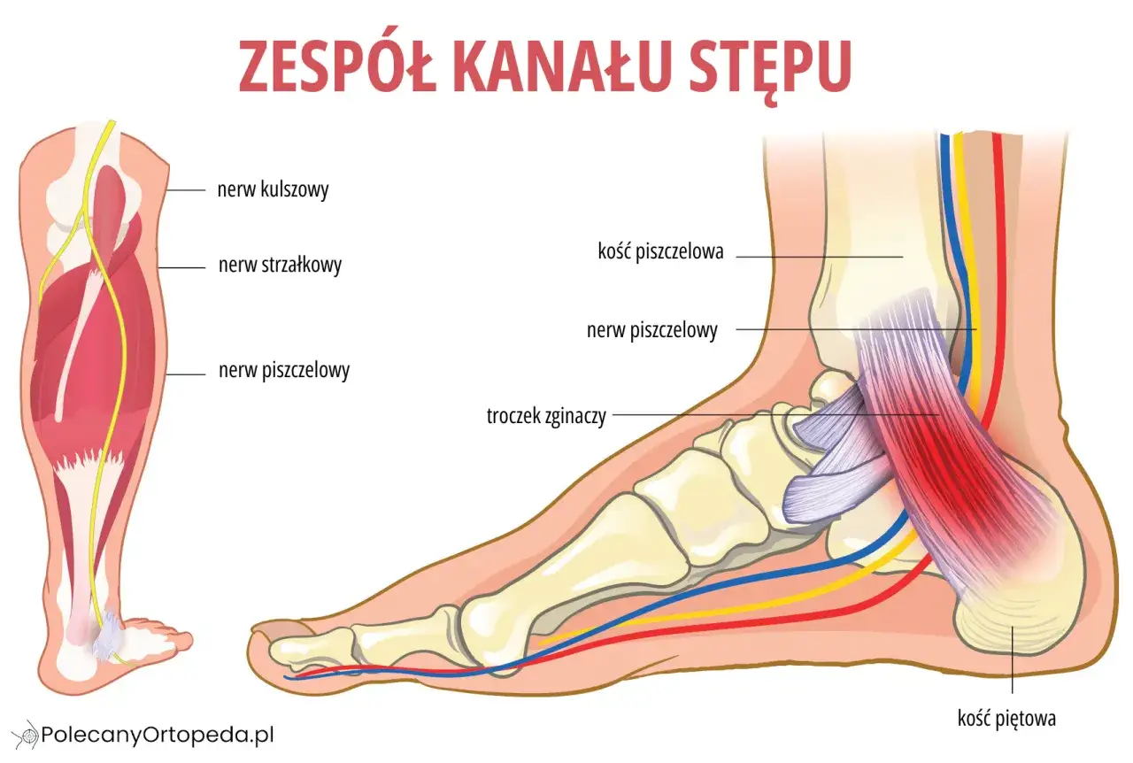 Ilustracja przedstawia anatomię stopy i łydki, ukazując nerwy i kości. Może pomóc zrozumieć przyczyny drętwienia pięty.