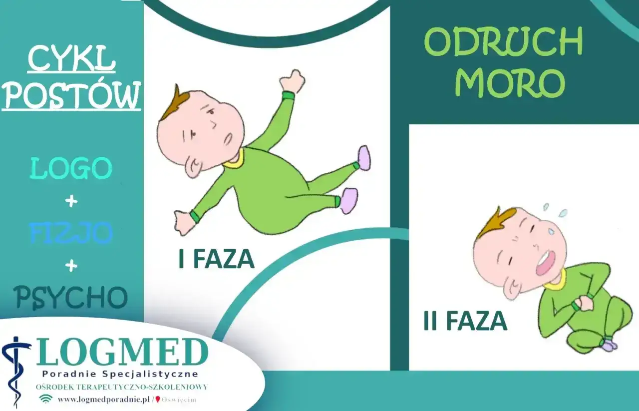 Ilustracja przedstawia dwie fazy odruchu Moro u niemowląt. Na pierwszym planie dziecko w zielonym pajacyku, z wyciągniętymi rączkami i nóżkami, w fazie I. Na drugim planie, w fazie II, dziecko skulone, płaczące.