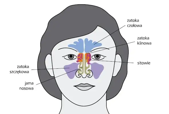 anatomia zatok przynosowych, rodzaje zapalenia zatok schemat