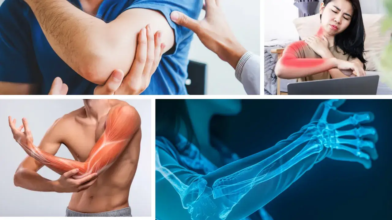 Frau mit Schmerzen im linken Oberarm, die am Laptop sitzt. Anatomische Darstellung von Muskeln und Knochen des Arms.