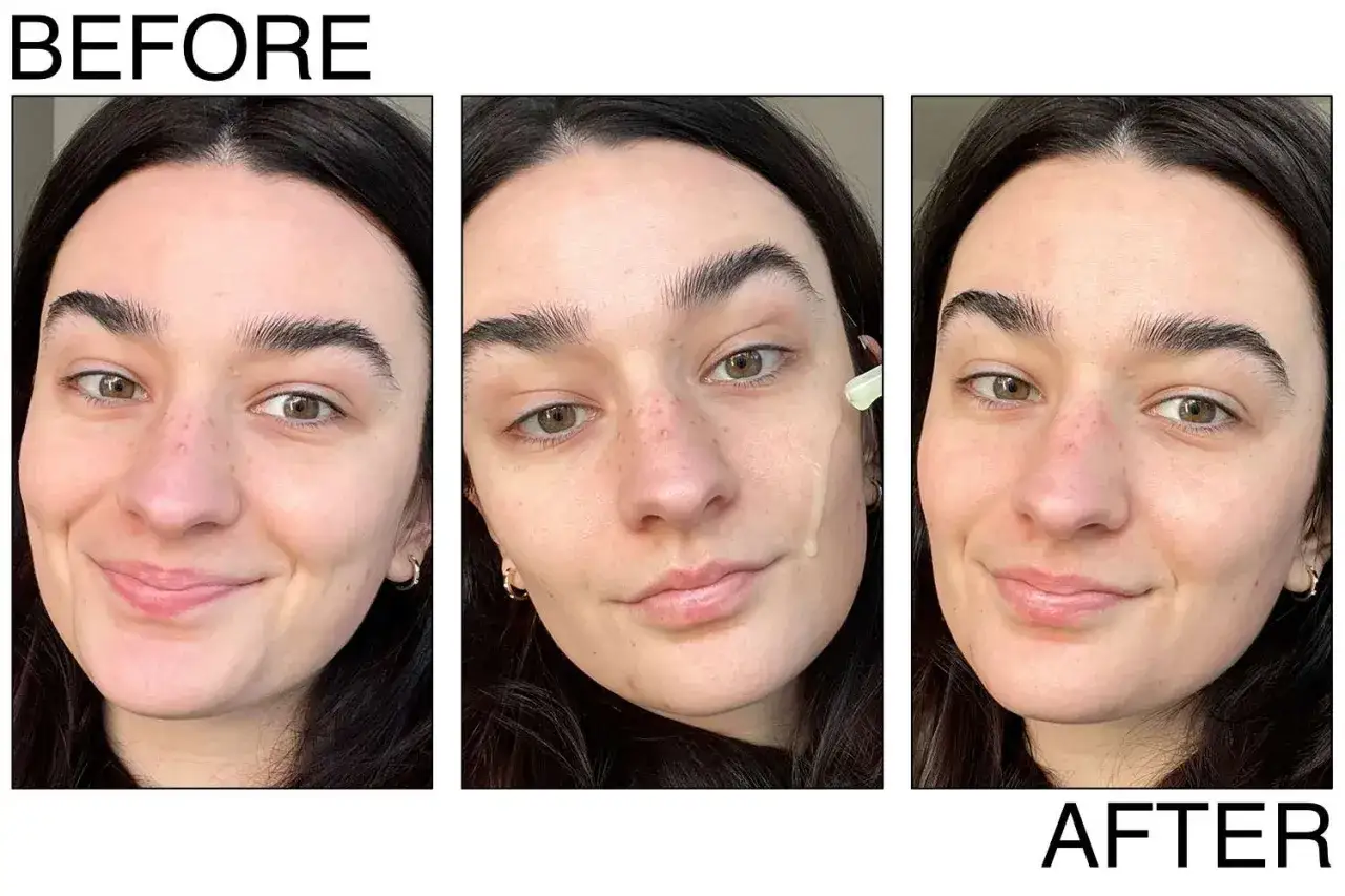 Przed i po zastosowaniu serum z retinolem. Skóra wygląda na nawilżoną i promienną.