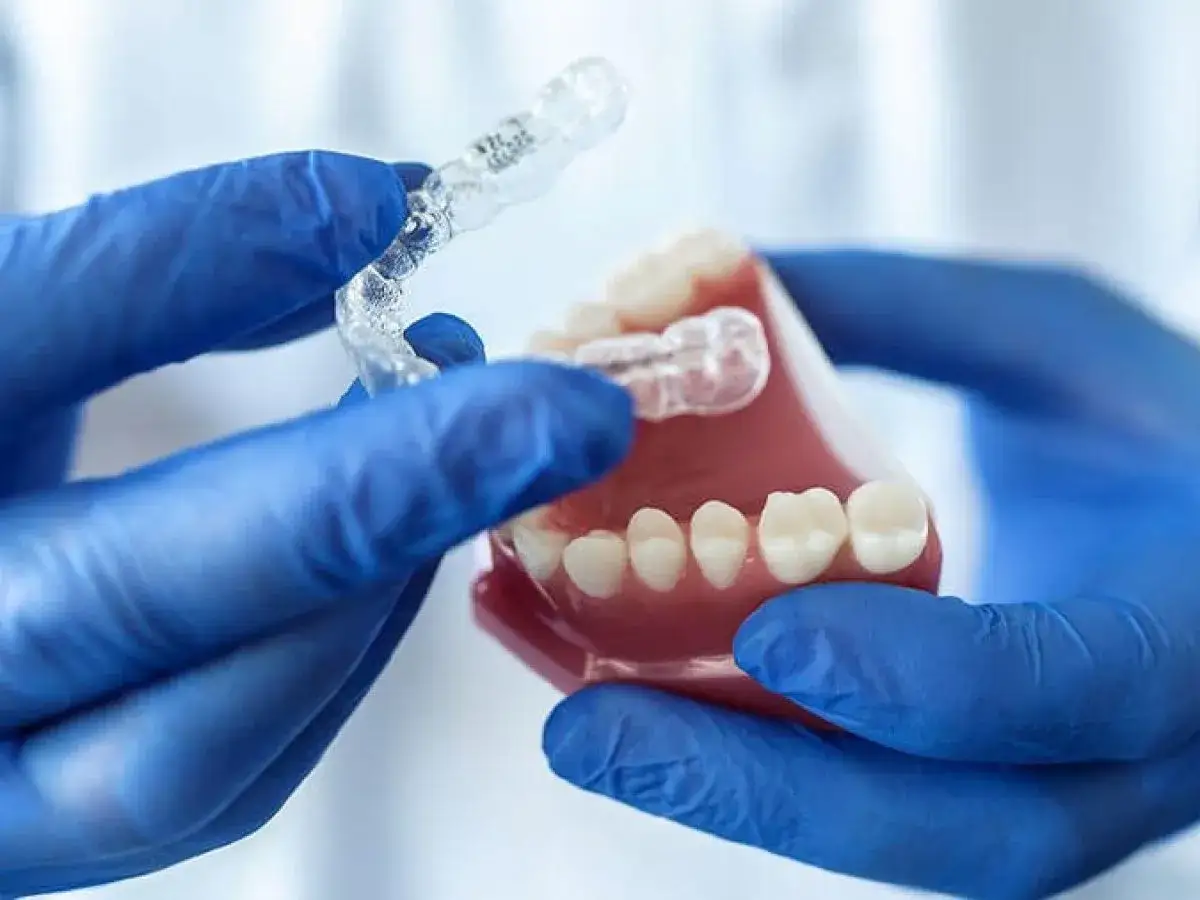 Mani guantate blu mostrano un apparecchio trasparente su un modello di denti. Scopri quanto costa un bite dal dentista per un sorriso perfetto.