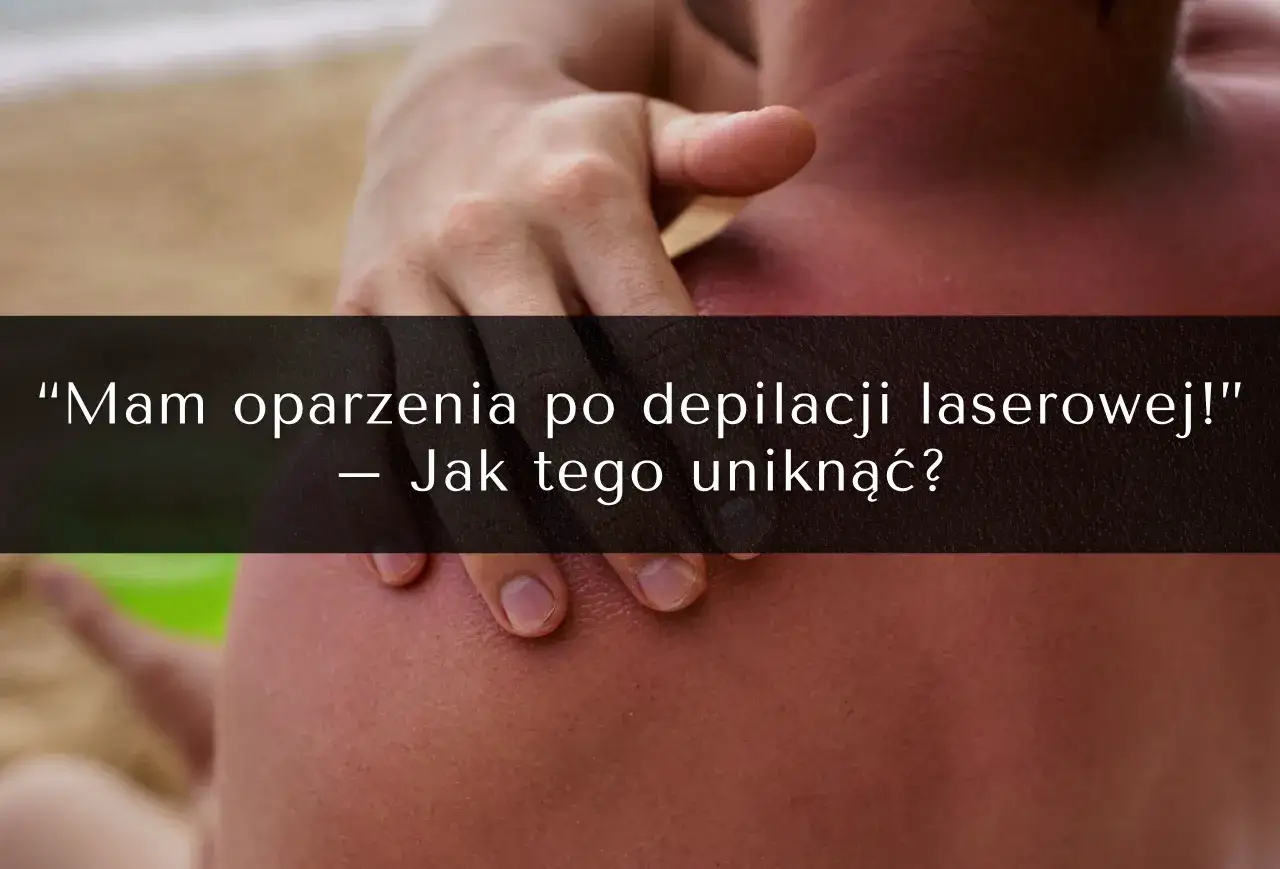 skóra po depilacji laserowej i słońce ryzyko