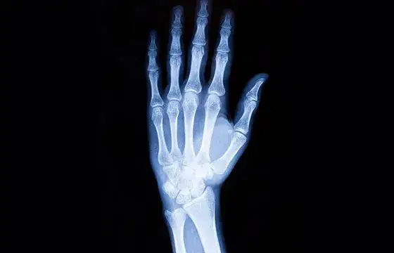 diagnostyka skręcenia nadgarstka RTG USG