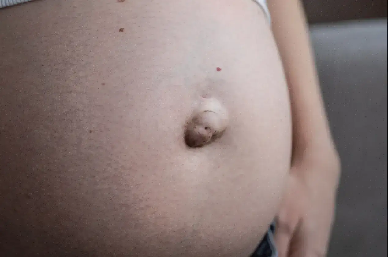Primo piano dell'ombelico in gravidanza, che sporge leggermente. La pelle &egrave; chiara, con qualche neo e smagliatura.