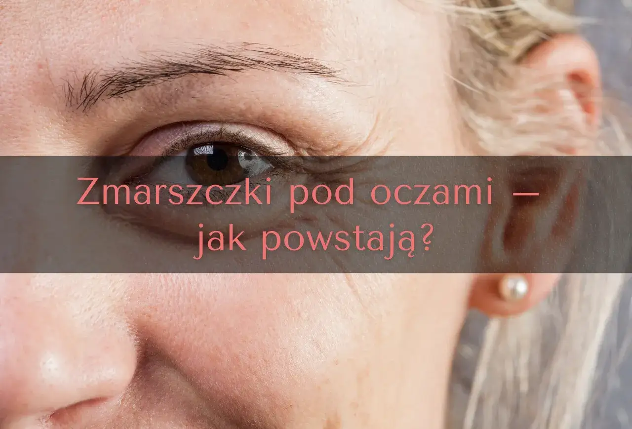 Zbliżenie na oko z widocznymi zmarszczkami. Czy zastanawiasz się, jaki zabieg na zmarszczki pod oczami będzie najskuteczniejszy?